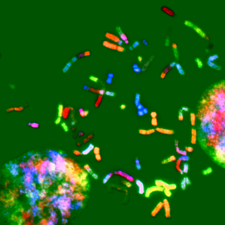 cancer chromosomes